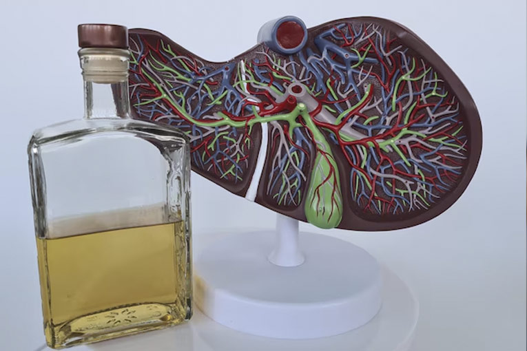 Alcohol Liver Disease (ALD) | JSS Hospital Blog