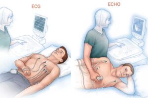 Difference between ECG and ECHO