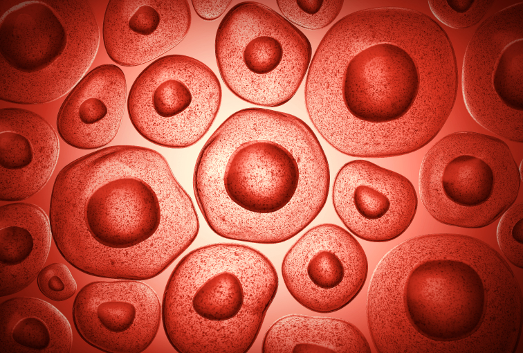 World Sickle Cell Day 2025: Shaping a Healthier Future Through Awareness and Care